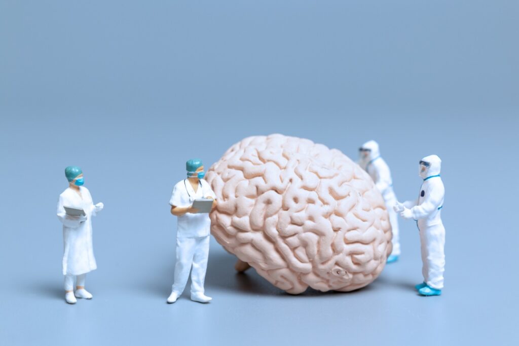 doctors examining a giant brain