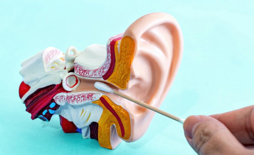 Ear cleaning with cotton swabs. Anatomical Ear Model